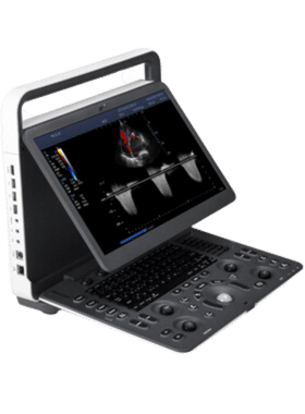 SonoPixel_portfolio_SonoScape_E2_hordozhato_ultrahangberendezes