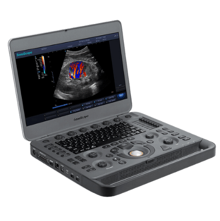 SonoPixel_portfolio_SonoScape_X3_hordozhato_ultrahang_berendezes