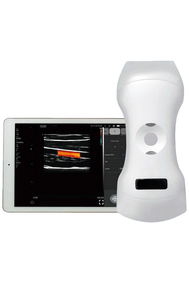 SonoStar_Pocus_kezi_ultrahangkeszulek